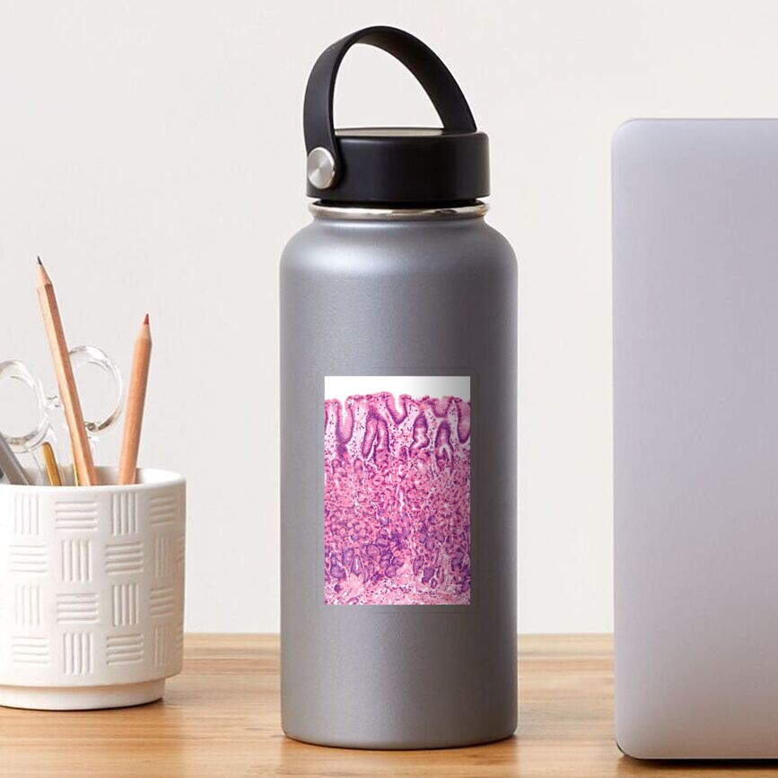 Aperçu de l'œuvre Sticker transparent créée et vendue par deltoid.