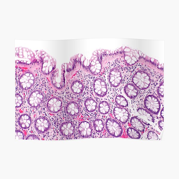 Gut Histology Poster