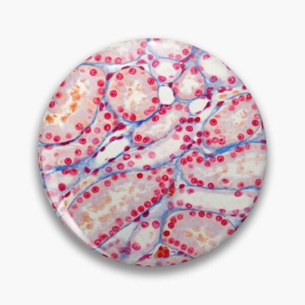 Item preview, Kidney tubules designed and sold by Love Histology.