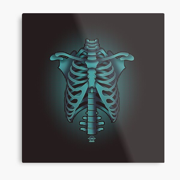 Human Rib Cage Metal Print