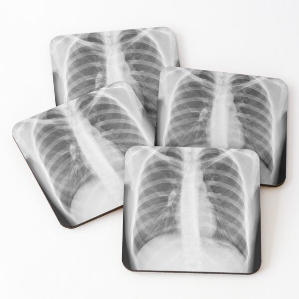 Item preview, Chest xray designed and sold by RonDoyle.