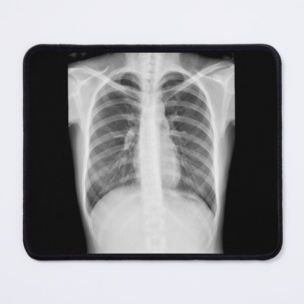 Item preview, Chest xray designed and sold by RonDoyle.