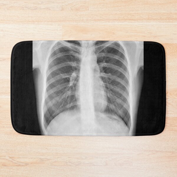 Item preview, Chest xray designed and sold by RonDoyle.