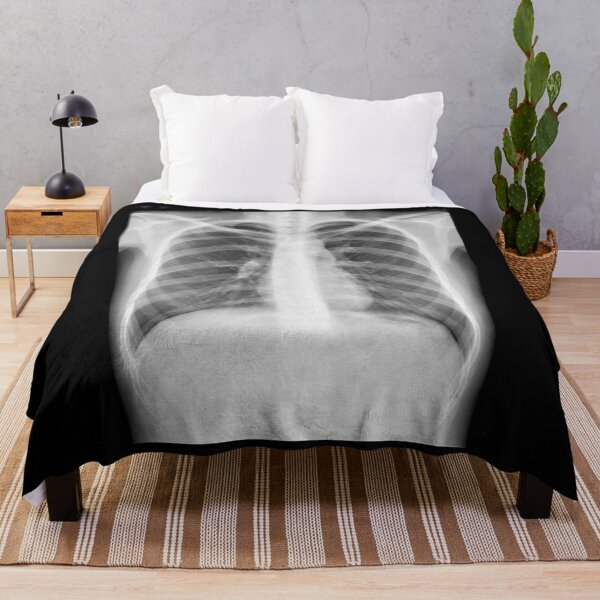 Item preview, Chest xray designed and sold by RonDoyle.