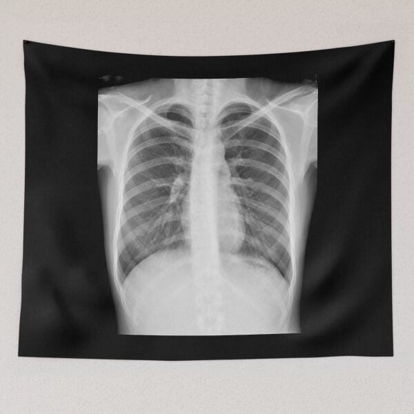 Item preview, Chest xray designed and sold by RonDoyle.
