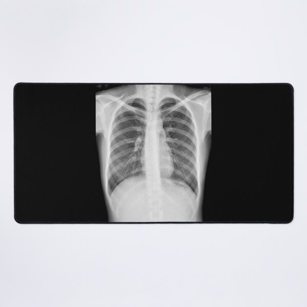 Item preview, Chest xray designed and sold by RonDoyle.