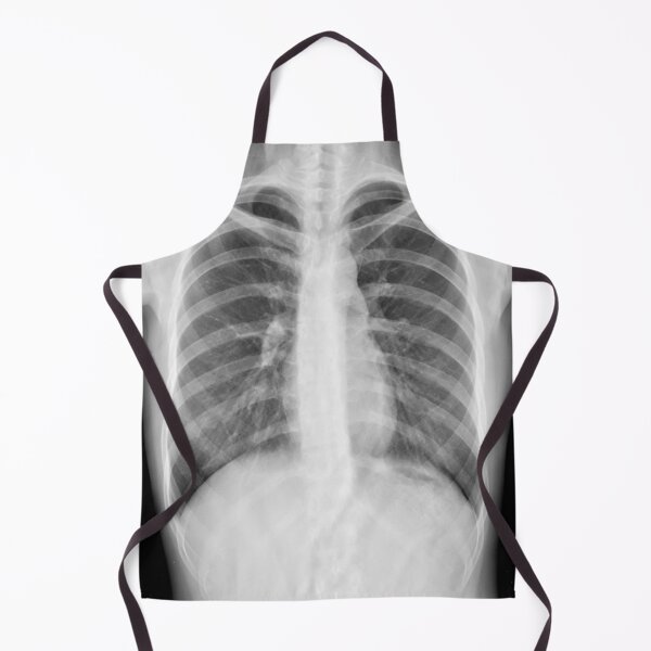 Item preview, Chest xray designed and sold by RonDoyle.