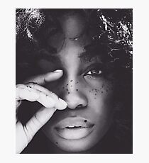 Lámina fotográfica SZA FRECKLES