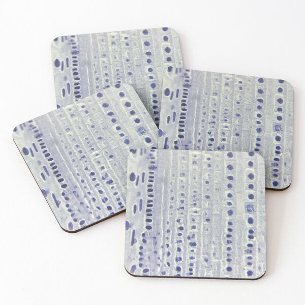 Item preview, Onion Root Tip Cells Flat  designed and sold by LuxeHurricane.