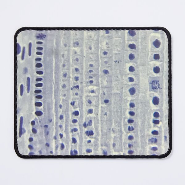 Item preview, Onion Root Tip Cells Flat designed and sold by LuxeHurricane.