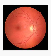 Retina Photographic Print