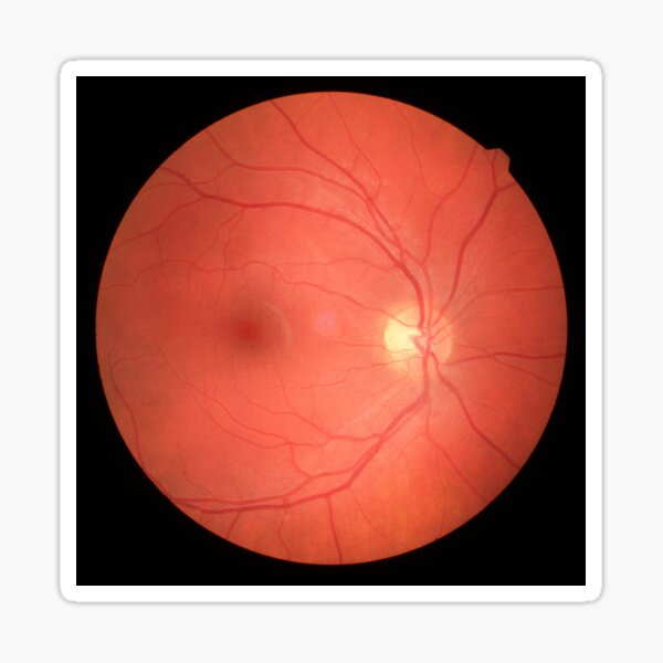 Item preview, Retina  designed and sold by Tyloor.
