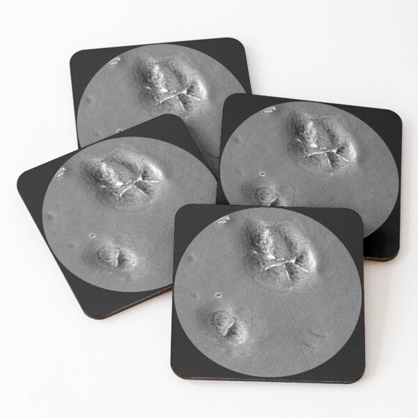 Item preview, When fashion meets technology: art and science micrographs of epithelial cells. Gray Circle designed and sold by ArtByScience.