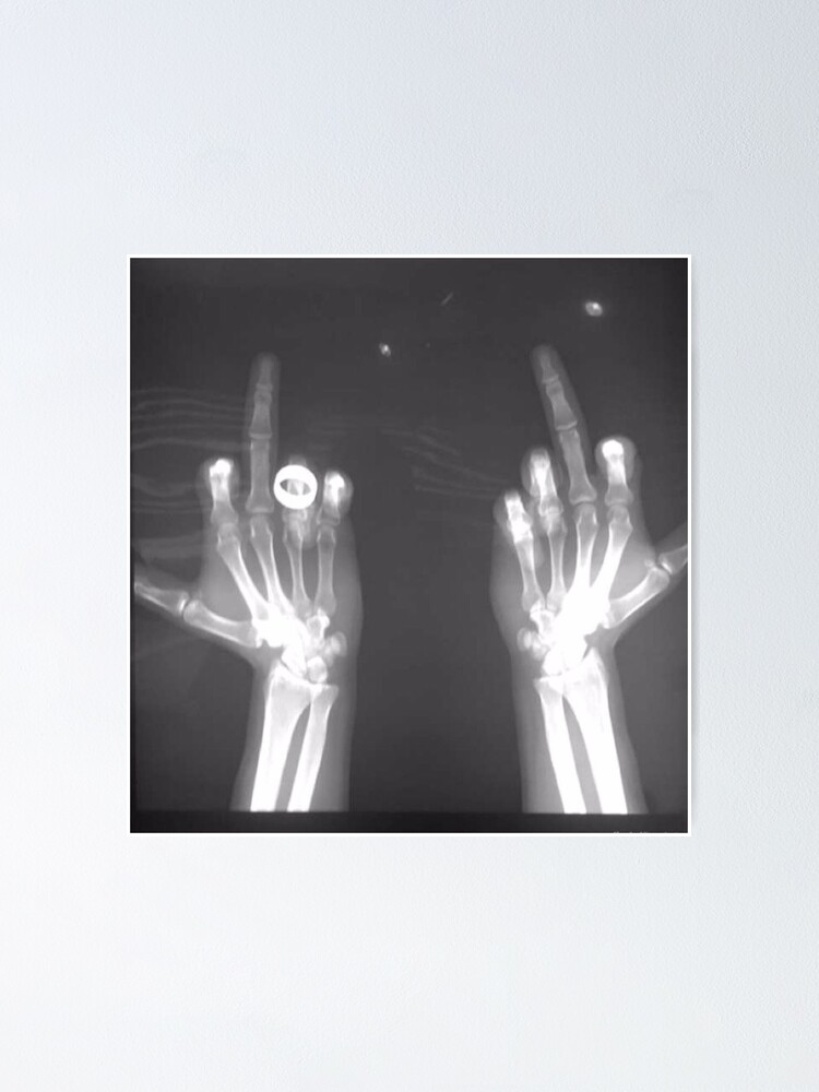 &ldquo;x-ray middle finger&rdquo; Poster for Sale by hm15 | Redbubble