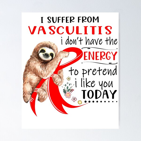 Item preview, I Suffer From Vasculitis i don't have the Energy To Pretend I Like You Today designed and sold by RunningShop.