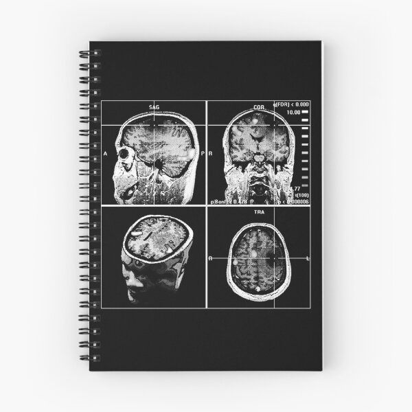 Item preview, Brain scan designed and sold by oxLeinadxo.