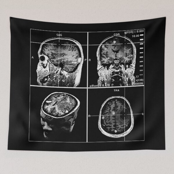 Item preview, Brain scan designed and sold by oxLeinadxo.