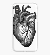PHD Heart Throb iPhone Case
