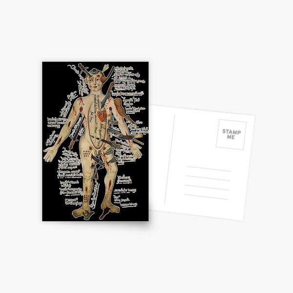 Item preview, The Many Lives of the Medieval Wound Man - 16th centuries  designed and sold by MINDTHECHERRY.