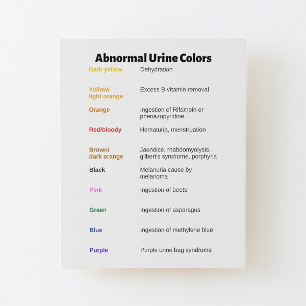 Abnormal Urine Colors Chart Art Board Print for Sale by Caregiverology