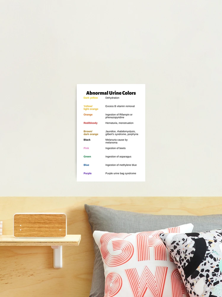 Abnormal Urine Colors Chart Photographic Print for Sale by
