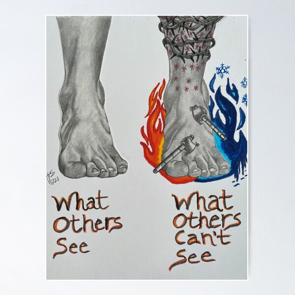 Item preview, Complex Regional Pain Syndrome (CRPS)  designed and sold by EmbodimentArt.