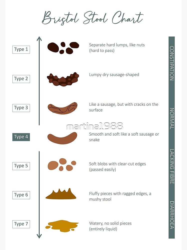 Bristol Stool chart Premium Matte Vertical Poster sold by Áurea | SKU ...