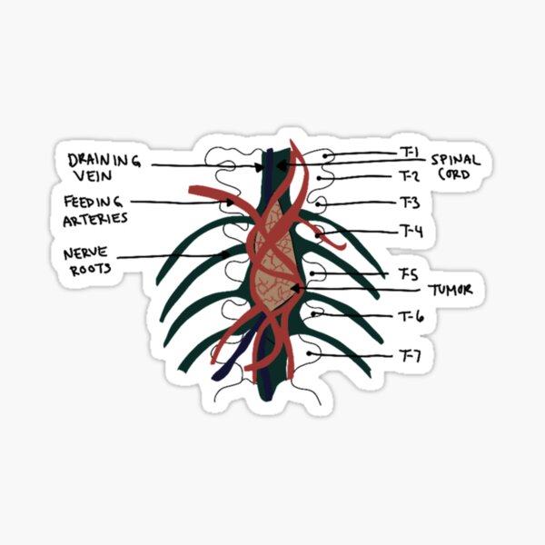 Tumeur de Grey's Anatomy Sticker