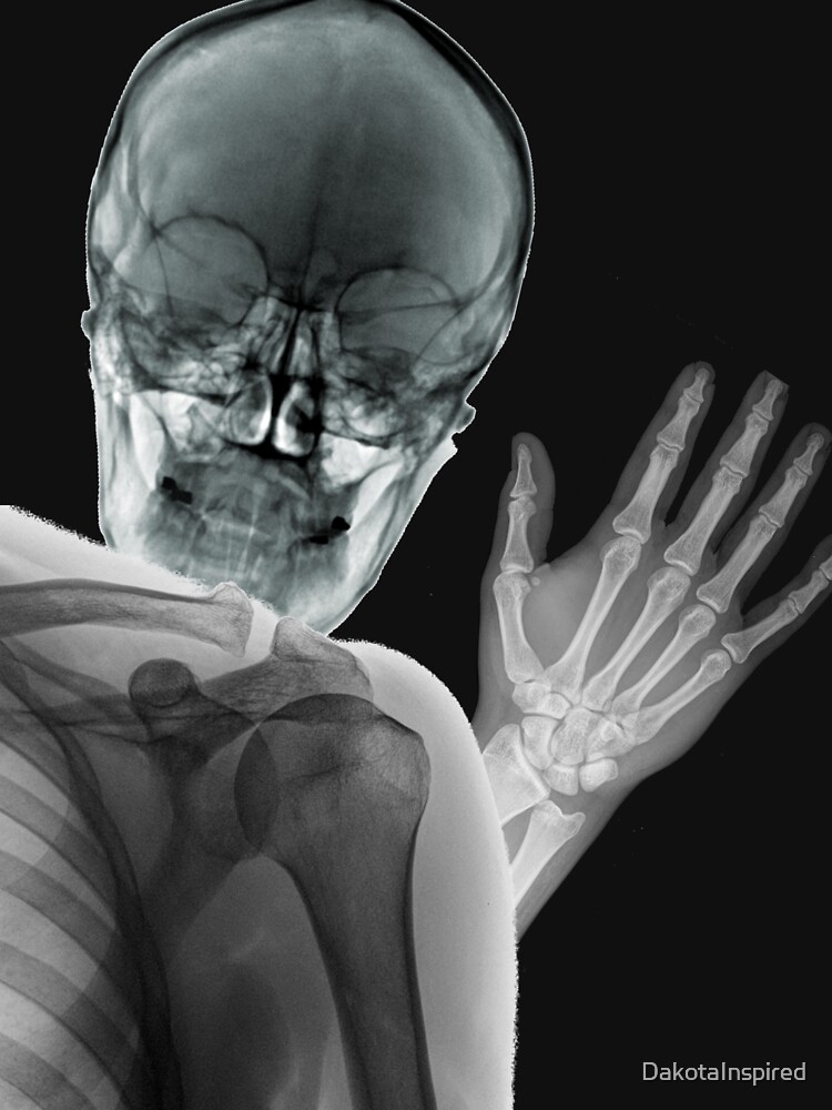Funny X Ray Photoby Dakotainspired Funny X Ray Photoby Dakotainspired