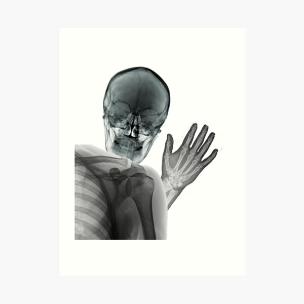 "Lustige RöntgenPhotobombe" Kunstdruck von DakotaInspired Redbubble