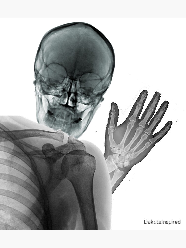 "Lustige RöntgenPhotobombe" Kunstdruck von DakotaInspired Redbubble