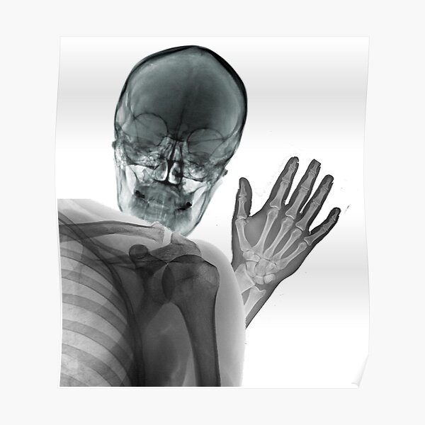 Xray Hand Posters for Sale | Redbubble Xray Hand Posters for Sale | Redbubble