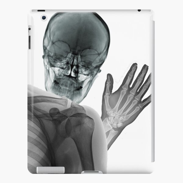 Xray Hand Ipad Cases Skins Redbubble - xray vision roblox