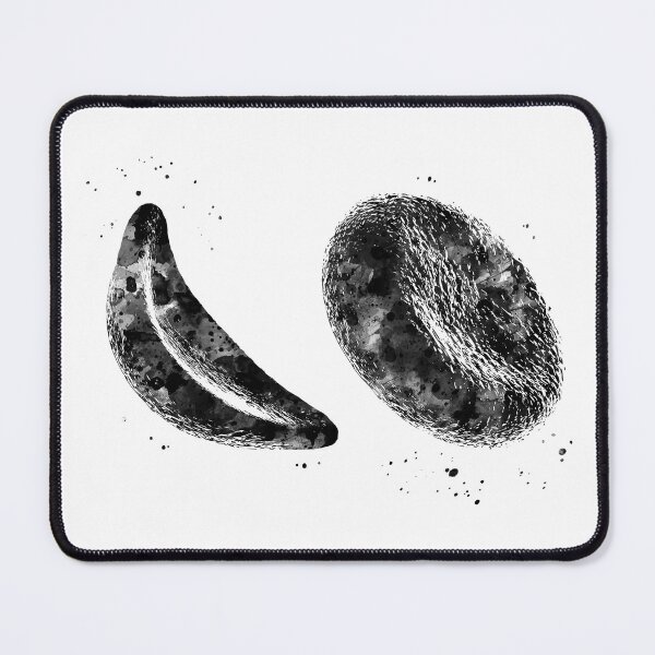 Item preview, Anemia Healthy and Sickle Shaped Red Blood Cells designed and sold by EvasDreams.