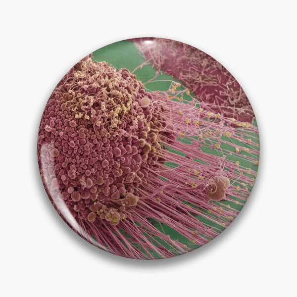 Item preview, Apoptotic HeLa Cell, SEM, Microscope Photo of Cancer Cell designed and sold by ScienceSource.