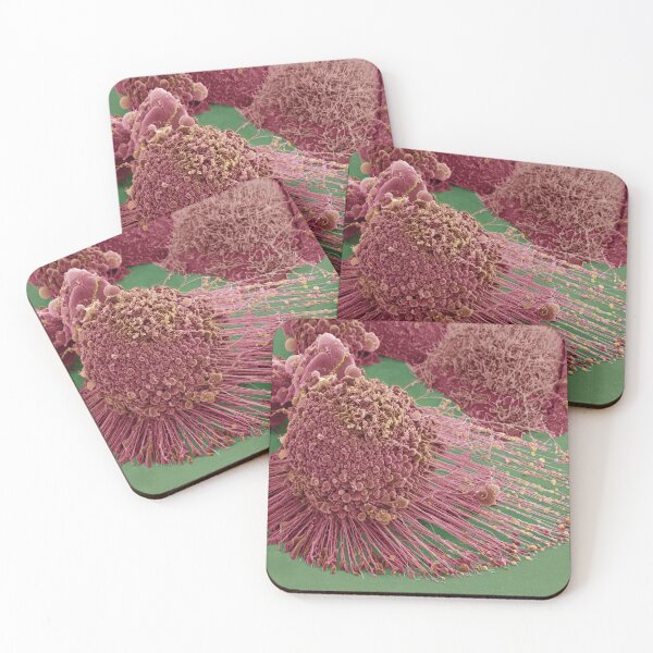 Item preview, Apoptotic HeLa Cell, SEM, Microscope Photo of Cancer Cell designed and sold by ScienceSource.