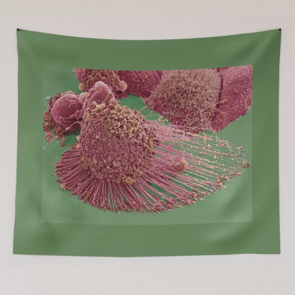 Item preview, Apoptotic HeLa Cell, SEM, Microscope Photo of Cancer Cell designed and sold by ScienceSource.