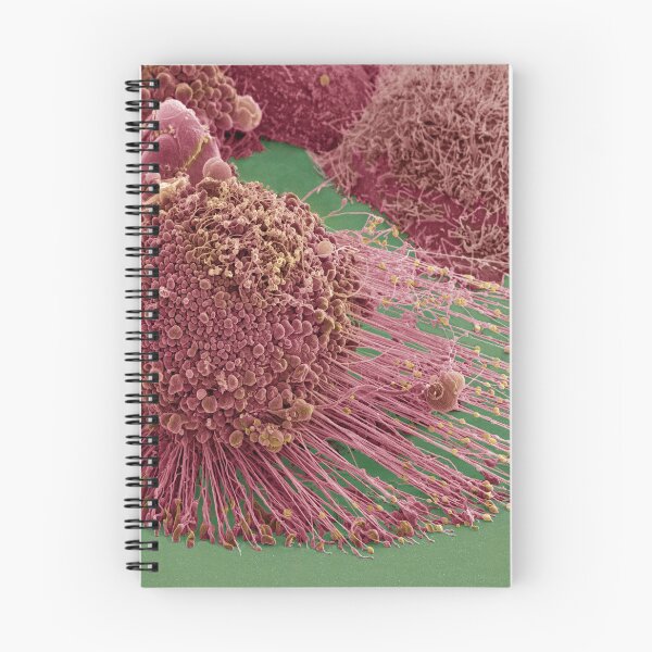 Item preview, Apoptotic HeLa Cell, SEM, Microscope Photo of Cancer Cell designed and sold by ScienceSource.
