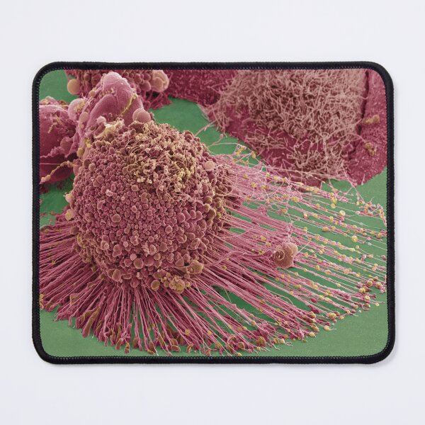Item preview, Apoptotic HeLa Cell, SEM, Microscope Photo of Cancer Cell designed and sold by ScienceSource.