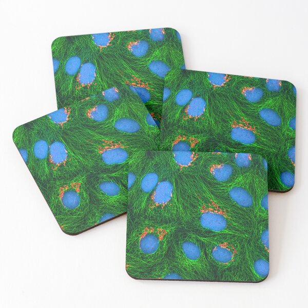 Item preview, HeLa Cancer Cell, Microscope Photo designed and sold by ScienceSource.