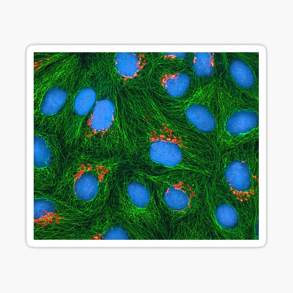 Item preview, HeLa Cancer Cell, Microscope Photo designed and sold by ScienceSource.