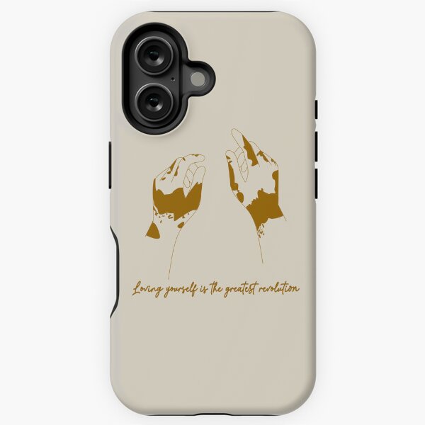 Item preview, Vitiligo awareness - Loving yourself is the greatest revolution designed and sold by Vivid-wear.