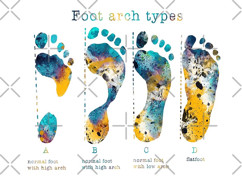 "Human types of footprintsfoot arch types" by Rosaliartbook Redbubble