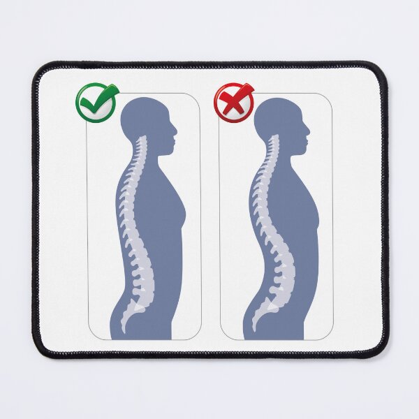 Item preview, Human anatomy lumbar hyper lordosis illustration. Ideal for catalogues, newsletters and medical guides designed and sold by LucianoCosmo.