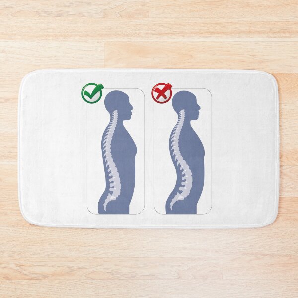 Item preview, Human anatomy lumbar hyper lordosis illustration. Ideal for catalogues, newsletters and medical guides designed and sold by LucianoCosmo.