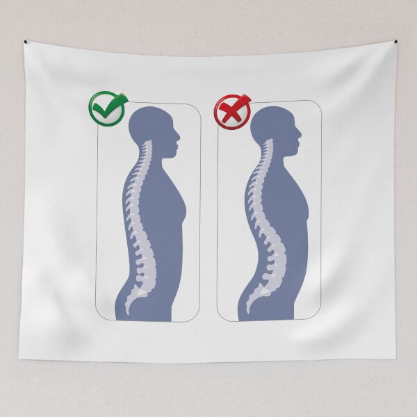 Item preview, Human anatomy lumbar hyper lordosis illustration. Ideal for catalogues, newsletters and medical guides designed and sold by LucianoCosmo.
