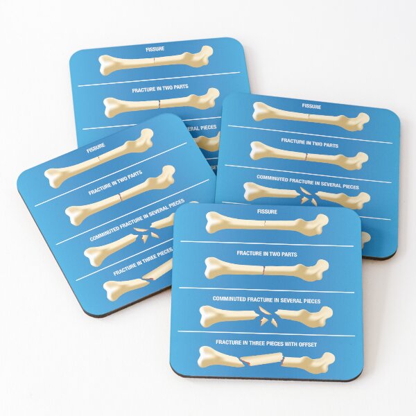 Item preview, Anatomy various skeletal bone fractures. Ideal for medical and institutional materials designed and sold by LucianoCosmo.