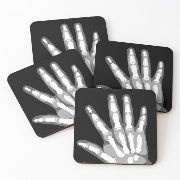 Item preview, Hand X Rays - Black and White - 1 of 3 designed and sold by Hodgepodge Bricolage.