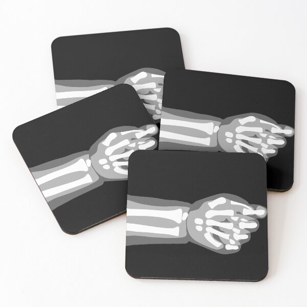 Item preview, Hand X Rays - Black and White - 2 of 3 designed and sold by Hodgepodge Bricolage.