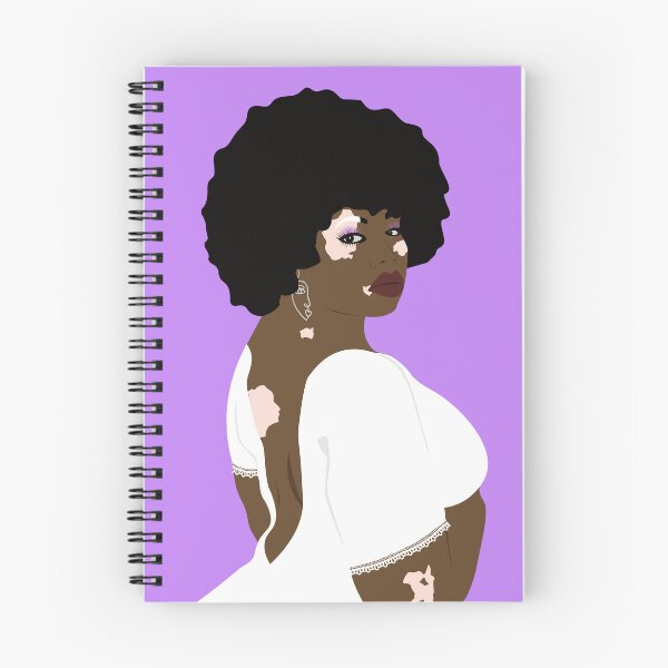 Item preview, Vitiligo beauty designed and sold by Tata-Boubou.